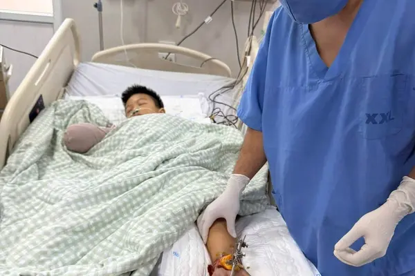 Cổng làng đổ sập đè bé trai 8 tuổi: Bác sĩ tạm nối bàn tay vào chân