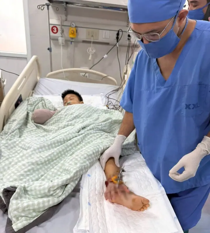 Cổng làng đổ sập đè bé trai 8 tuổi: Bác sĩ tạm nối bàn tay vào chân