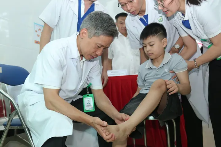 Bé 10 tuổi biến dạng bàn chân sau chấn thương sọ não