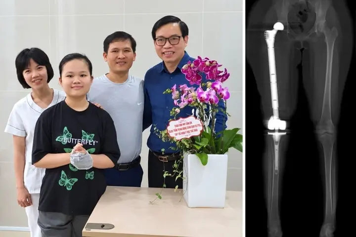 Cuộc hội ngộ đặc biệt giữa cô gái từng suýt mất chân và bác sĩ tại lễ khai giảng